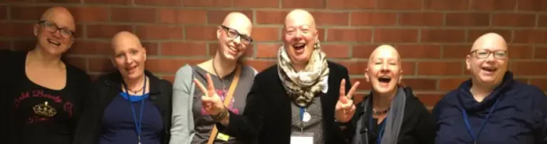 Alopecia Areata Deutschland e.V. (AAD) Header